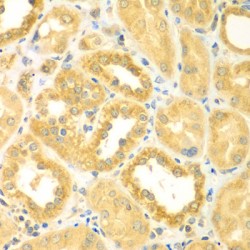 Myomegalin (PDE4DIP) Antibody