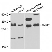 Western blot analysis of extracts of various cell lines, using TM2D1 antibody (abx007079) at 1/1000 dilution.