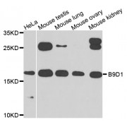 Western blot analysis of extracts of various cell lines, using B9D1 antibody (abx007102) at 1/1000 dilution.