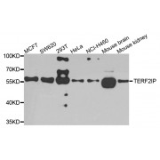 Western blot analysis of extracts of various cell lines, using TERF2IP antibody (abx007105) at 1/1000 dilution.