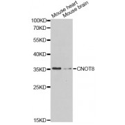 Western blot analysis of extracts of various cell lines, using CNOT8 Antibody (abx007115) at 1/1000 dilution.