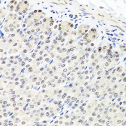 CCR4-NOT Transcription Complex Subunit 8 (CNOT8) Antibody