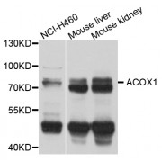 Western blot analysis of extracts of various cell lines, using ACOX1 antibody (abx007121) at 1/1000 dilution.