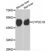 Western blot analysis of extracts of various cell lines, using CYP2C18 antibody (abx007135) at 1/1000 dilution.