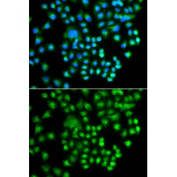 Protein Kinase cAMP-Activated Catalytic Subunit Gamma (PRKACG) Antibody