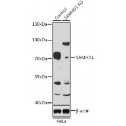 Deoxynucleoside Triphosphate Triphosphohydrolase SAMHD1 (SAMHD1) Antibody