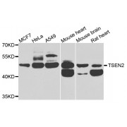 Western blot analysis of extracts of various cell lines, using TSEN2 antibody (abx007157) at 1/1000 dilution.