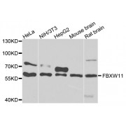 Western blot analysis of extracts of various cell lines, using FBXW11 antibody (abx007164) at 1/1000 dilution.