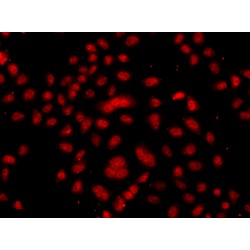 F-Box And WD Repeat Domain Containing 11 (FBXW11) Antibody
