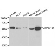Western blot analysis of extracts of various cell lines, using ATP6V1B1 antibody (abx007167) at 1/1000 dilution.