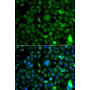 Immunofluorescence analysis of A549 cells using DPF1 antibody (abx007172). Blue: DAPI for nuclear staining.