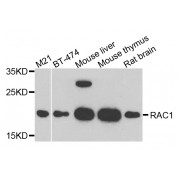Western blot analysis of extracts of various cell lines, using RAC1 antibody (abx007176) at 1/1000 dilution.