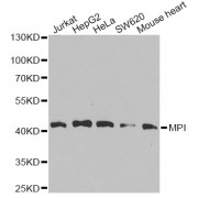 Western blot analysis of extracts of various cell lines, using MPI antibody (abx007189) at 1/1000 dilution.