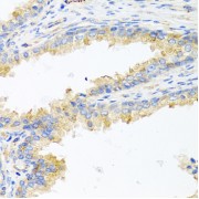 Immunohistochemistry of paraffin-embedded human prostate using ApoE antibody (abx007195) at dilution of 1/100 (40x lens).
