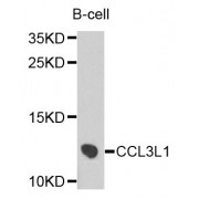 Western blot analysis of extracts of B-cell cells, using CCL3L1 antibody (abx007203) at 1/1000 dilution.