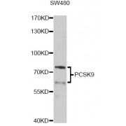 Western blot analysis of extracts of SW480 cells, using PCSK9 Antibody (abx007236) at 1/1000 dilution.