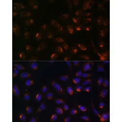 Inositol 1,4,5-Trisphosphate Receptor Type 1 (ITPR1) Antibody