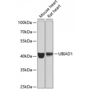 Western blot analysis of extracts of various cell lines, using UBIAD1 antibody (1/1000 dilution).