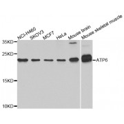 Western blot analysis of extracts of various cell lines, using ATP6 antibody (abx007312) at 1/1000 dilution.