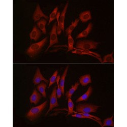 Cyclic GMP-AMP Synthase (CGAS) Antibody