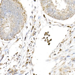 Cyclic GMP-AMP Synthase (CGAS) Antibody