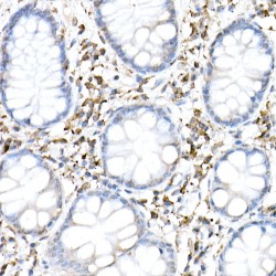 Cyclic GMP-AMP Synthase (CGAS) Antibody