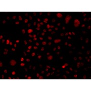 Immunofluorescence analysis of A549 cells using ARID1A antibody (abx007322).