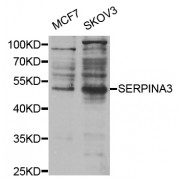 Western blot analysis of extracts of various cell lines, using SERPINA3 antibody (abx007324) at 1/1000 dilution.