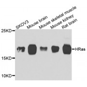 Western blot analysis of extracts of various cell lines, using HRAS antibody (abx007354) at 1/1000 dilution.