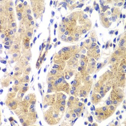 GTPase HRas (HRAS) Antibody