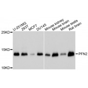 Western blot analysis of extracts of various cell lines, using PFN2 antibody (abx123013) at 1/1000 dilution.