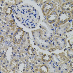 Alanine--TRNA Ligase, Cytoplasmic (AARS1) Antibody