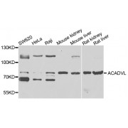 Western blot analysis of extracts of various cell lines, using ACADVL antibody (abx123041) at 1/1000 dilution.