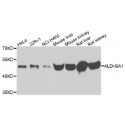 Western blot analysis of extracts of various cell lines, using ALDH9A1 antibody (abx123045) at 1/500 dilution.