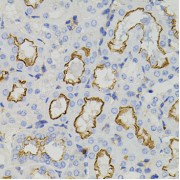 Immunohistochemistry of paraffin-embedded mouse kidney using STX1A antibody (abx123057) (40x lens).