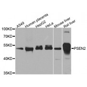 Western blot analysis of extracts of various cell lines, using PSEN2 antibody (abx123066) at 1/1000 dilution.