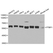 Western blot analysis of extracts of various cell lines, using PTBP1 antibody (abx123070) at 1/1000 dilution.