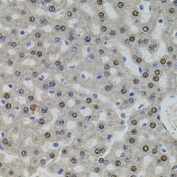 U2 SnRNP Associated SURP Domain Containing / SR140 (U2SURP) Antibody