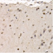 Immunohistochemistry of paraffin-embedded rat brain using RAD1 antibody (abx123204) at dilution of 1/200 (40x lens).
