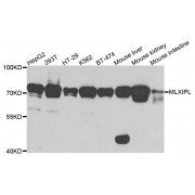 Western blot analysis of extracts of various cell lines, using MLXIPL antibody (abx123214) at 1/1000 dilution.