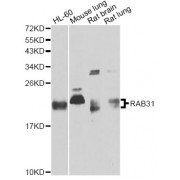 Western blot analysis of extracts of various cell lines, using RAB31 antibody (abx123241) at 1/1000 dilution.