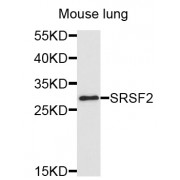 Western blot analysis of extracts of mouse lung, using SRSF2 antibody (abx123259) at 1/1000 dilution.