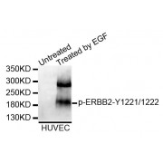 Western blot analysis of extracts of HUVEC cell line, using Phospho-ERBB2-Y1221/1222 antibody (abx123300).
