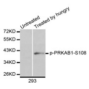 Western blot analysis of extracts of 293 cells, using Phospho-AMPKβ1-S108 antibody (abx123343) at 1/1000 dilution.