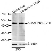 Western blot analysis of extracts of 293 cells, using Phospho-MAP2K1-T286 antibody (abx123368) at 1/1000 dilution. 293 cells were treated by PMA/TPA (200nM) for 30 minutes after serum-starvation overnight.
