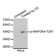 Western blot analysis of extracts of HeLa cells, using Phospho-MAP2K4-T261 antibody (abx123370).