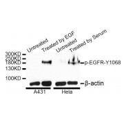 Western blot analysis of extracts of A-431 and HeLa cells, using Phospho-EGFR-Y1068 antibody (abx123379) at 1/1000 dilution. A431 cells were treated by EGF (100ng/ml) for 30 minutes after serum-starvation overnight. HeLa cells were treated by 10% FBS after serum-starvation overnight.