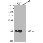Western blot analysis of extracts of various cell lines, using Acetyl-Histone H3-K14 antibody (abx123384) at 1/1000 dilution.