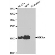 Western blot analysis of extracts of various cell lines, using Acetyl-Histone H3-K9 antibody (abx123385) at 1/1000 dilution.
