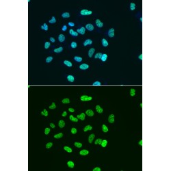 Histone H3 Acetyl-Lys9 (H3 AcK9) Antibody